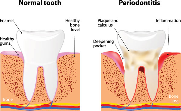 Durham Dental Studio | Dental Sealants, Night Guards and Cosmetic Dentistry