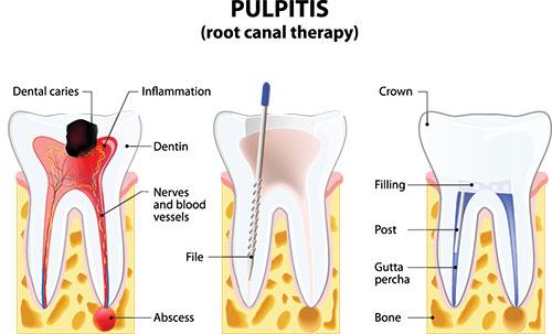 Durham Dental Studio | Snoring Appliances, Digital Impressions and Dental Lab