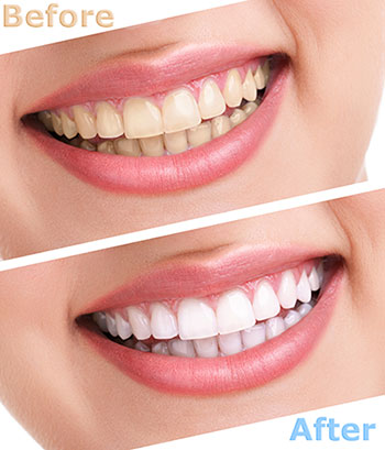 Durham Dental Studio | Periodontal Treatment, TMJ Disorders and Teeth Whitening